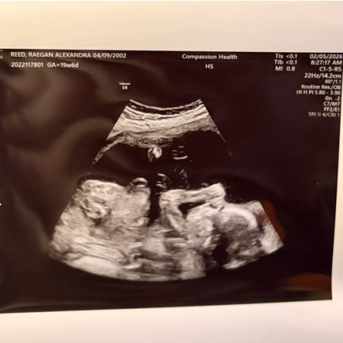 Maternity Leave Fund