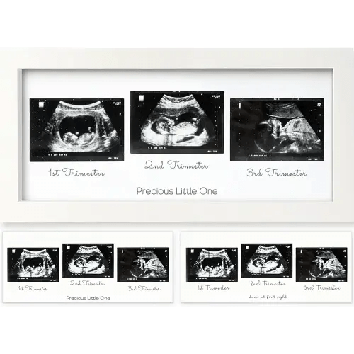 Sonogram Picture Frame - Trio Ultrasound Picture Frames For Mom To Be Gift - Baby Ultrasound frame - Pregnancy Announcements Sonogram frame - Baby Nursery Decor, Pregnant Mom Gifts(Alpine White)