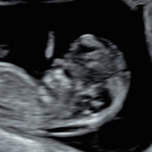Amazon: Baby Registry
