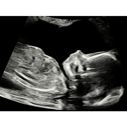 Fundraiser by Becki Potteiger : Potteiger Maternity Leave