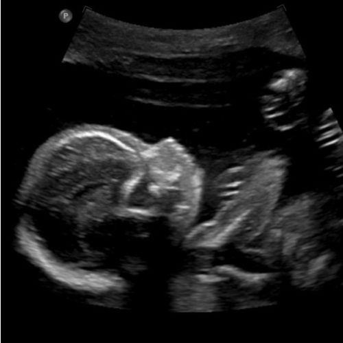 Baby Lazaroff Cash Fund