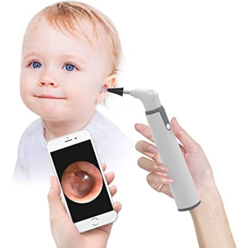 Wireless Otoscope, Ear Scope with 720P HD Ear Camera and 6 LED Lights, Ear Wax Removal Tool Camera with Gyroscope, Digital Otoscope with Light, Compatible with iPhone and Android