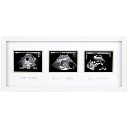 Pearhead Triple Sonogram Pregnancy Keepsake Frame, Watch Baby Grow Through All Three Trimesters - Great Gift for Expecting Parents, Baby Shower Gift, White - Trimester Sonogram Frame, White