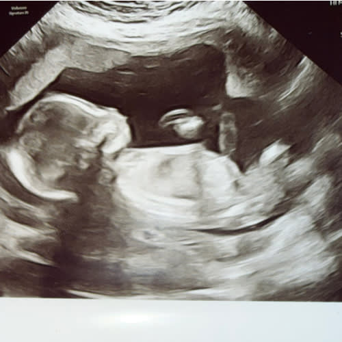 Amazon: Baby Registry