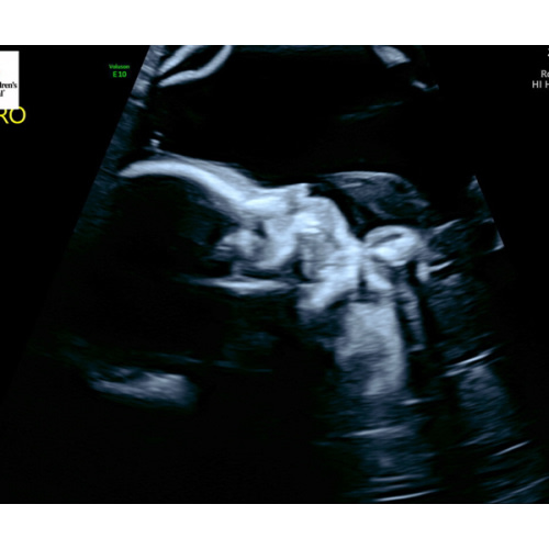 New Baby & Postpartum Care Fund