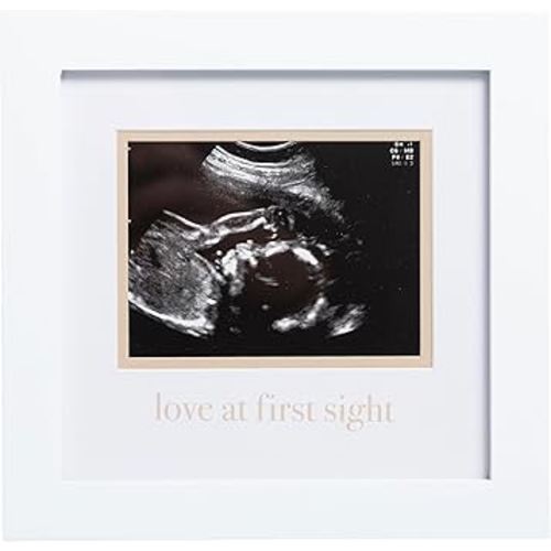 Pearhead Love At First Sight Sonogram Frame, Ultrasound Picture Frame, Pregnancy Announcement Photo Frame, Baby Keepsake Gift For Expecting Parents