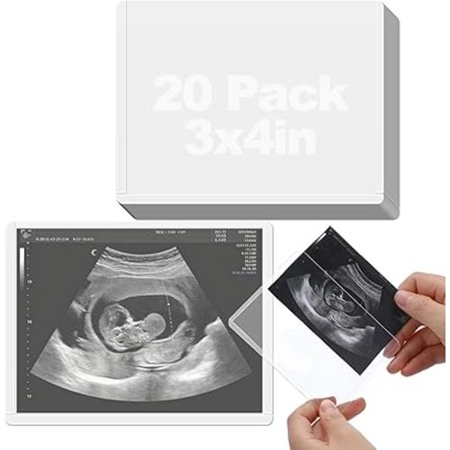 Easy Insert Photo Protector for 3x4in Ultrasound Pictures - Side-Loading to Keep Baby Sonogram Picture/Special Memories Safe, Pregnancy Journal Must Haves, Pregnancy Gifts for Expecting Mom, 20 Pack