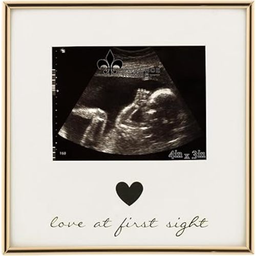 5x3 Sonogram - Ultrasound Gold Metla Picture Frame - Love at First Sight Design