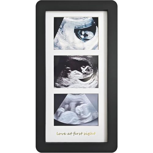 Love at First Sight Ultrasound Picture Frames,Triple Ultrasound Picture Frames,Sonogram Picture Frame 3 Photos,Pregnancy Announcements (Black)