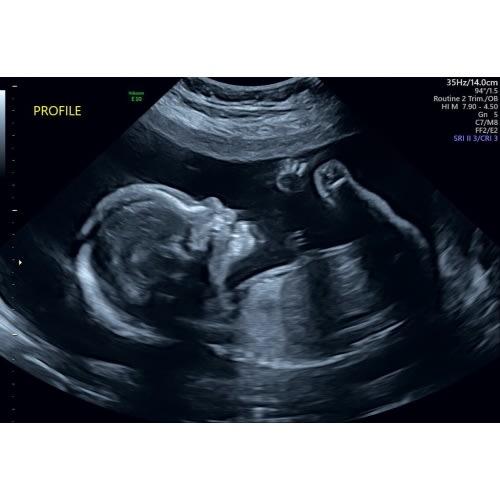 CLICK HERE FOR AMAZON REGISTRY