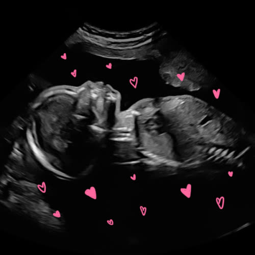 Baby Girl Essentials Fund ✨