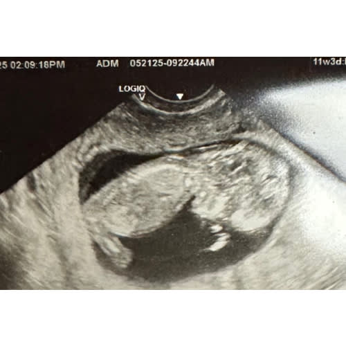 Baby’s Cash Fund