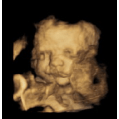 Bean's Education Fund - Bet on Bean! GIRL OR BOY???