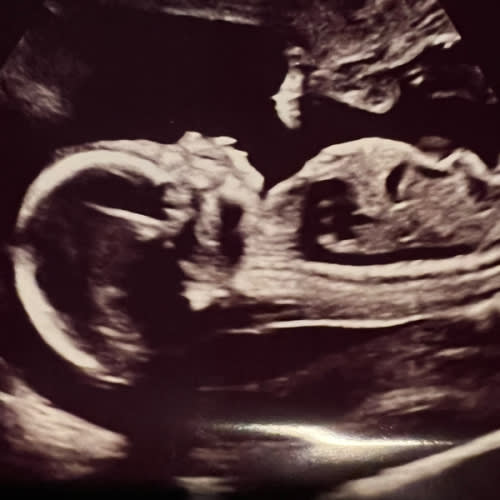 Babylist Parental Leave Fund