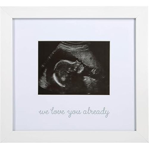 Kate & Milo We Love You Already Ultrasound Picture Frame, Keepsake Sonogram Frame for Expecting Parents, Baby, and Nursery Decor, White