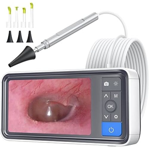 ScopeAround Otoscope Ear Camera with 4.5" IPS Screen, FHD Digital Otoscope with Gyroscope, FSA HSA Eligible Item, 32GB Card Ear Scope Otoscope with Light, Ear Wax Removal Tool Camera, Home Ear Checker