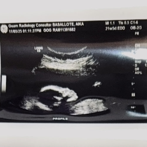 Diapers, Parental Leave, &... Newly Weds?