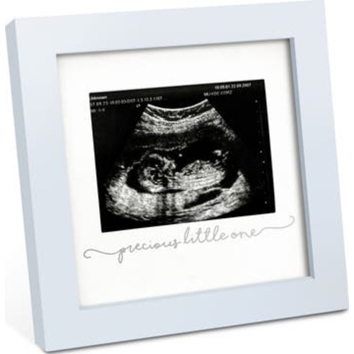 Solo Baby Sonogram Frame