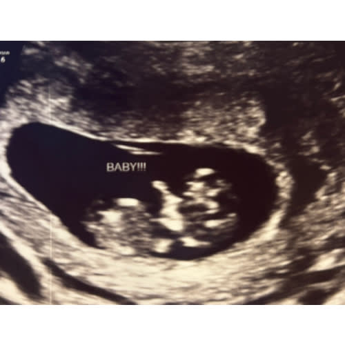 Babylist Parental Leave Fund