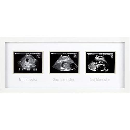 Pearhead Sonogram Progression Frame - Trimester by Trimester Pregnancy Milestone Keepsake, Gender-Neutral Nursery Decor, Displays 1st, 2nd & 3rd Trimester Ultrasound Photos, White