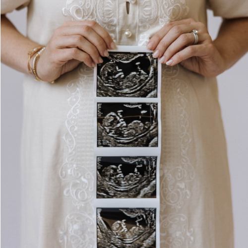 3D/4D Ultrasound Session