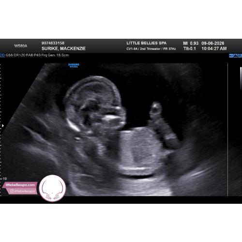 Cash Fund for baby stroller