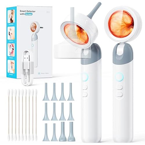 Qimic Otoscope Ear Camera with 1.38'' Screen, 1080P Ear Scope with 4 LEDs, 12 Silicone Specula Tips, Support Photo and Video, PC View, Ideal Pocket Otoscope for Adults, Kids and Pets
