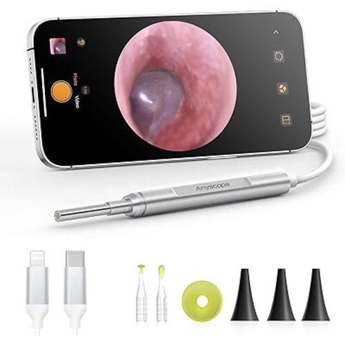 Digital Otoscope Compatible with iPhone & Android, Video Ear Scope Camera