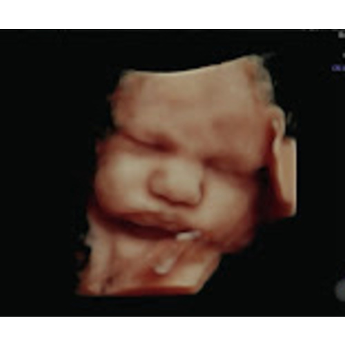 Miracle In Progress 3D/4D Ultrasound: Love at First Sight Package