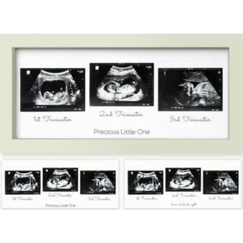 Trio Baby Sonogram Frame