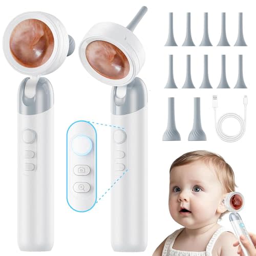Otoscope Ear Camera with Light, 1.4” Screen 1080P HD Ear Scope | 12 Silicone Specula Tips, Photo & Video Recording, Type-C Rechargeable, Ear Otoscope Camera for Adult Kid and Pet