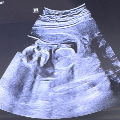 Add the Babylist Button