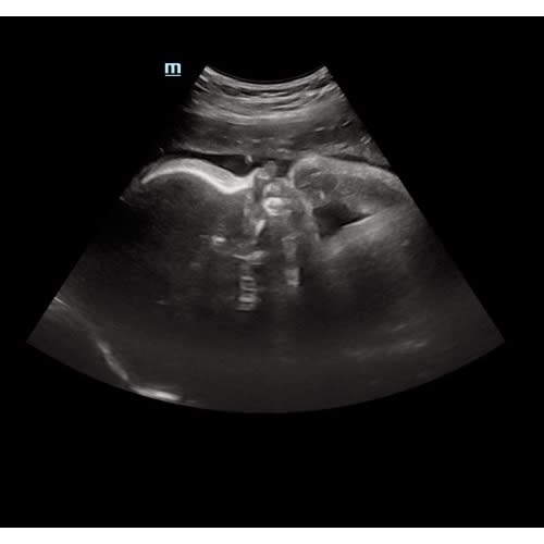 Cash Fund for Large Items