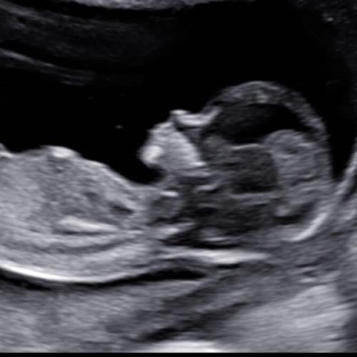 The “We Have No Idea What We’re Doing” Fund ….to help manage all the unexpected bumps and celebrations along the way!