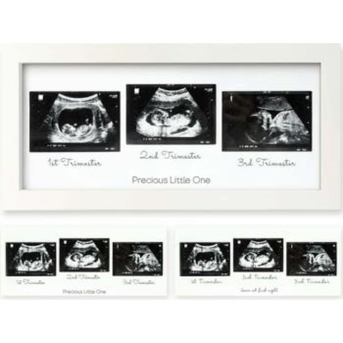 Trio Baby Sonogram Frame