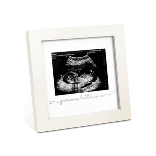 KeaBabies Baby Sonogram Picture Frame - Modern Ultrasound Picture Frames for Mom to Be, First Pregnancy Gifts for Expecting Mom & First Time Dad, Baby Gender Reveal Gifts (Alpine White)