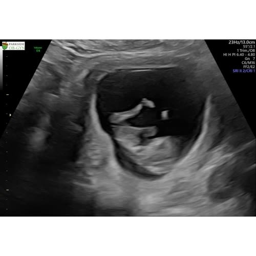 Necessities & Parental Leave Fund