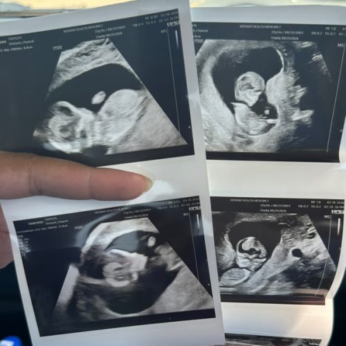 Chaunai’s Time out of the classroom