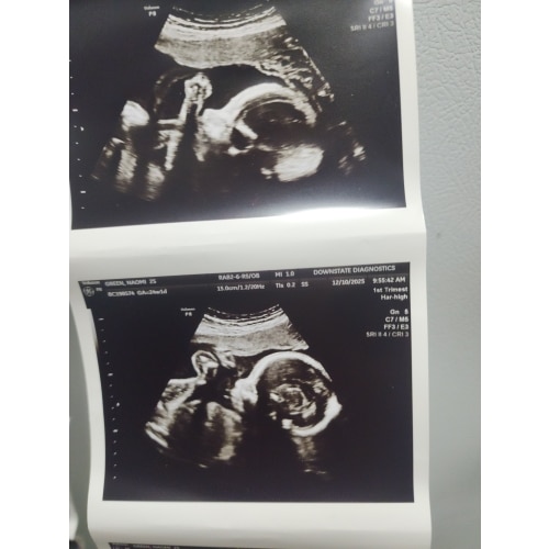 Birth & Paternal Leave Help 🌱