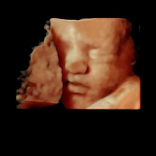 Maternity Leave Fund