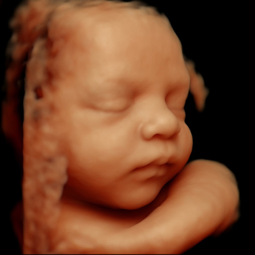 Alaina Lisovich and Eric Booth’s Baby Registry at Babylist