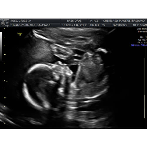 Baby Girl Prenatal and Delivery Medical Expenses Fund
