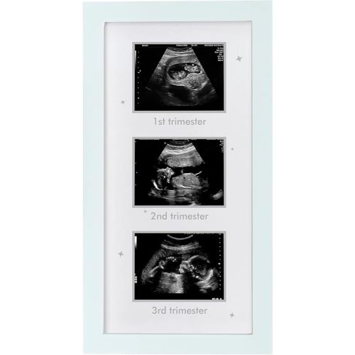 Ultrasound Picture Frame - Triple Sonogram Frame for Mom to Be | Pregnancy Photo Album Decor | Baby Nursery Essentials & Gender Reveal Gifts | First Trimester Keepsake & Pregnancy Must Haves - White2