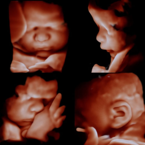 peek-a-boo 4D scan