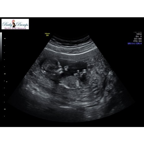 Babylist Cash Fund