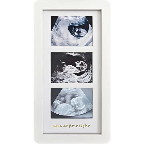 Love at First Sight Ultrasound Picture Frames,Triple Ultrasound Picture Frames,Sonogram Picture Frame 3 Photos,Pregnancy Announcements (White)