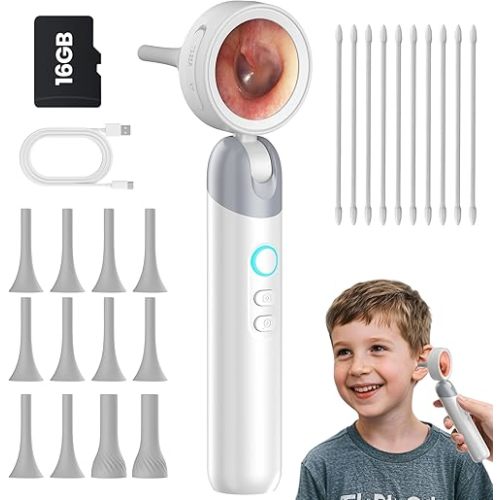 Digital Otoscope Camera with Light – HD Screen 90° Foldable Support Photo Video and PC View, Ear Infection Detector, Pocket Ear Scope with Earwax Removal Tool for Family Adults, Kids and Pets