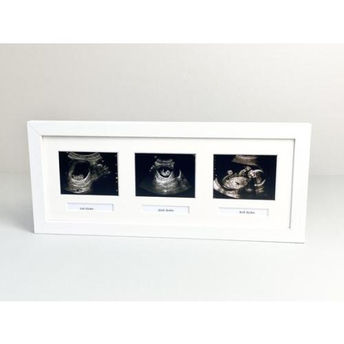 Baby Scan Photo Frame - Multi aperture Frame for Three Scan sized Photos and Three Text Boxes.  Handmade by Art@Home. (BS6)