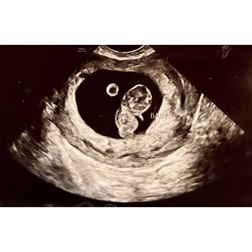 Baby Fund