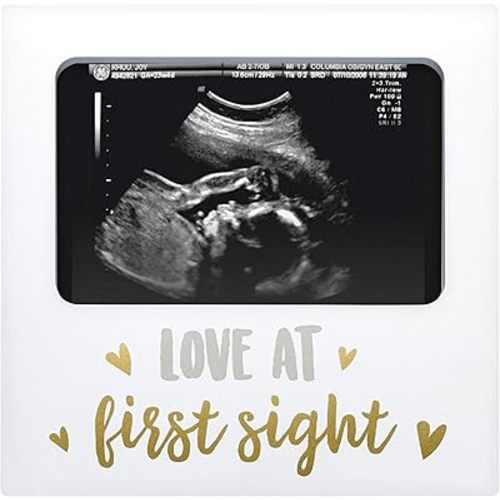 Tiny Ideas Love at First Sight Sonogram Picture Frame, Gender Neutral Ultrasound Keepsake, Ideal Pregnancy Gift, Baby Shower and Nursery Decor, 4” x6” Photo Insert, Gold, Silver And White
